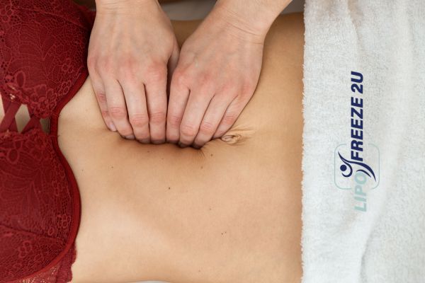 diastasis recti treatment Epping