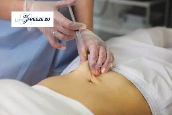 Fat Dissolving Injections Epping & Weight loss medication