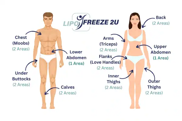 Areas you can have fat freezing treatment Epping