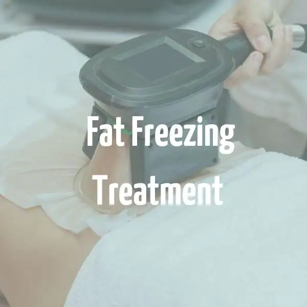 fat freezing treatment Epping