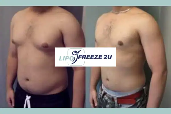 How Long Does It Take to See Results Epping?