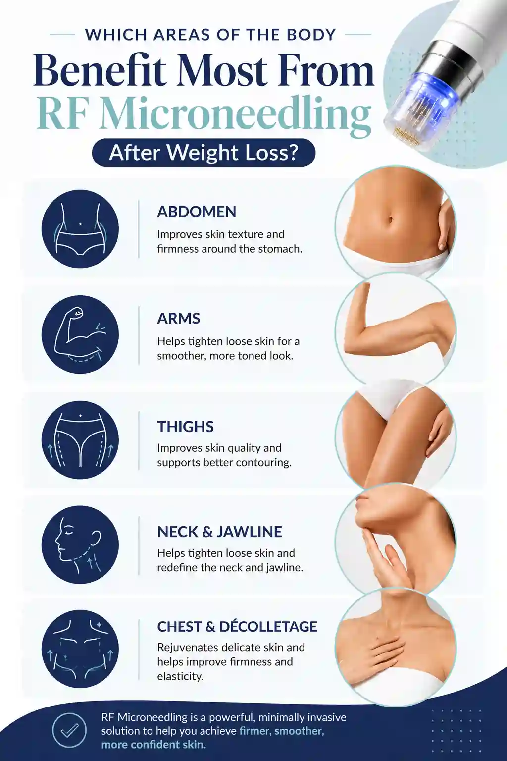 Which Areas of the Body Benefit Most From RF Microneedling After Weight Loss Epping